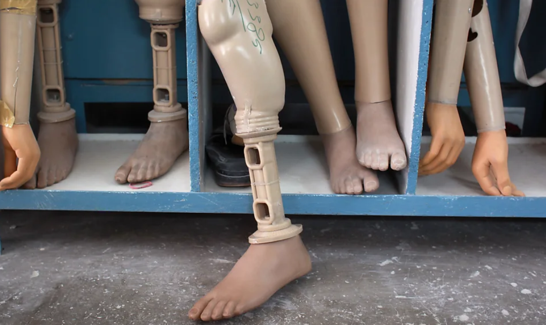 Sejarah Kaki Palsu: Dari Mesir Kuno hingga Prostesis Modern